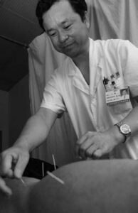 a man doing acupuncture 
